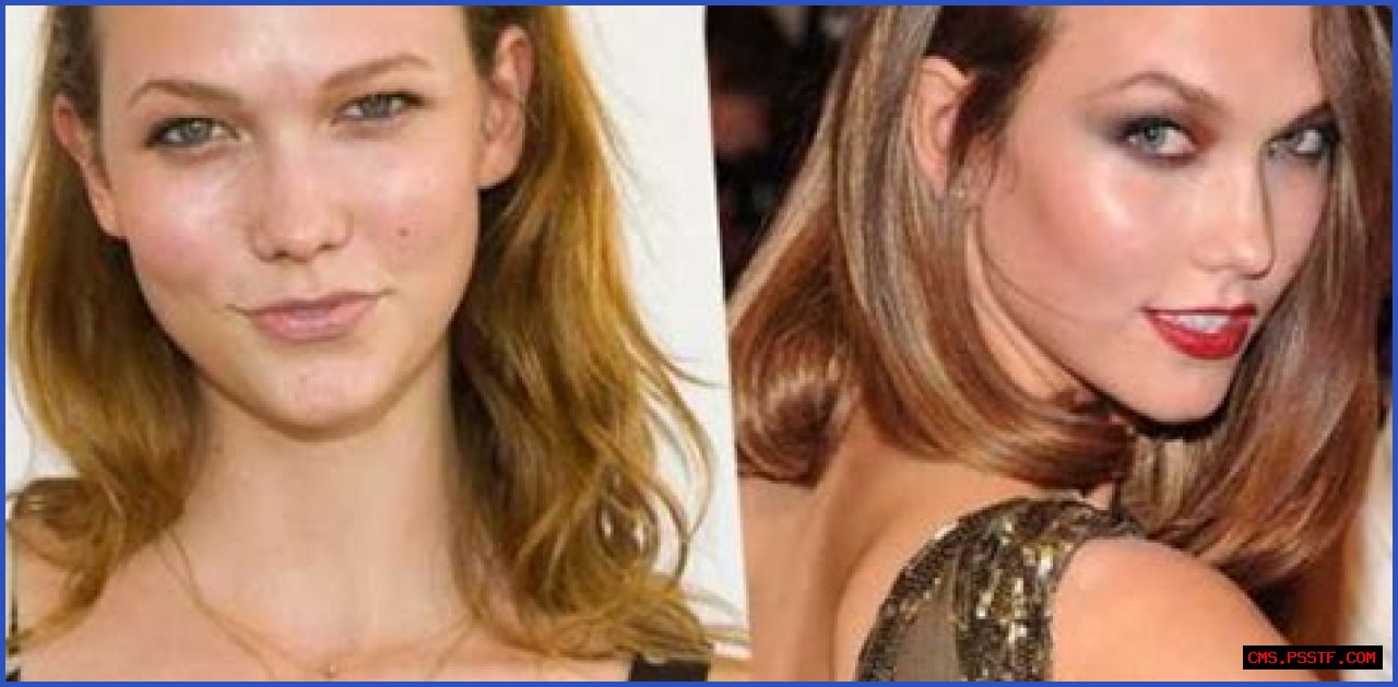 Karlie Kloss Plastic Surgery Before and After